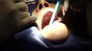 انواع درمان های دندانپزشکی توسط متخصصین کلیینیک مدرن