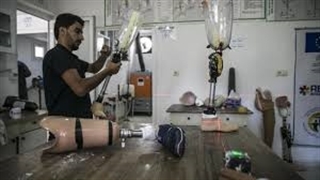 در مرکز ساخت عضو مصنوعی برای مجروحان جنگ سوریه چه می‌گذرد؟