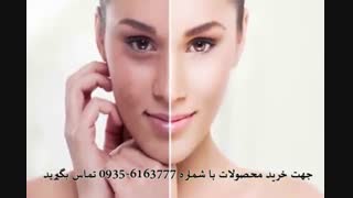سفارش کرم ضد لک 5040 ( 09356163777 ) جراحی پف زیر چشم