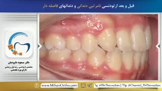 ارتودونتیست تهران | دکتر داودیان