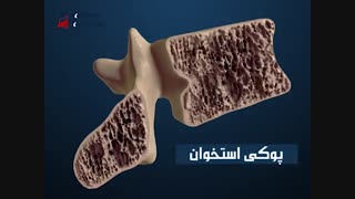 تقویت سیستم عضلانی و اسکلتی بدن