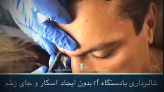خالبرداری با آر اف جرمگیری