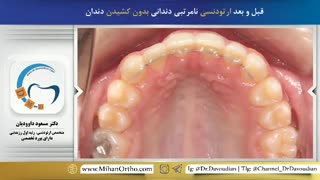 ارتودونتیست تهران | دکتر داودیان