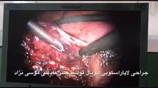 جراحی لاپاراسکوپی ادرنال