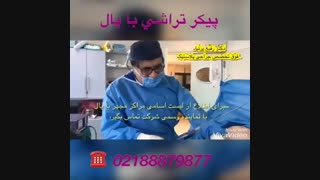 فیلم پیکر تراشی ماموپلاستی
