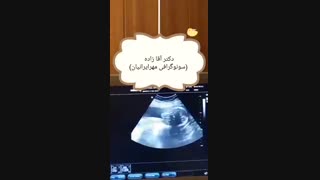 سونوگرافی از جنین 24 هفته