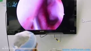 فیلم کامل عمل جراحی زیبایی بینی