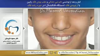 ارتودنسی | دکتر فاضل فیروزی جراحی گوش