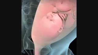 تغییر شکل بدن در بارداری