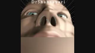 جراحی انحراف بینی