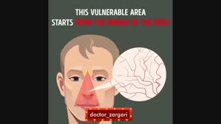 عدم استفاده از موچین برای کندن موهای بینی