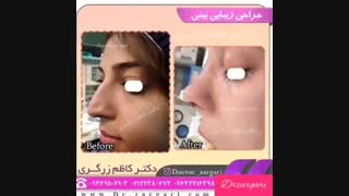 برخی از نمونه کارهای دکتر کاظم زرگری آر اف فرکشنال