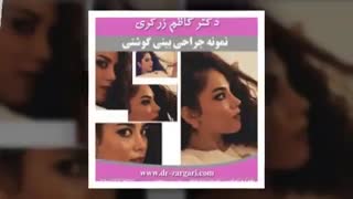 برخی از نمونه کارهای دکتر کاظم زرگری لیزر مو