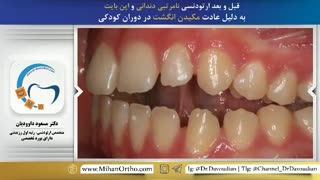 بهترین دکتر ارتودنسی تهران