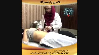لاغری سریع بدون جراحی پر کردن دندان