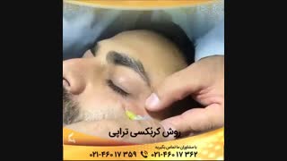 کربوکسی تراپی پلاستیک لثه