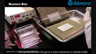 westernblooting 2- آزمایشگاه پاستور اهواز