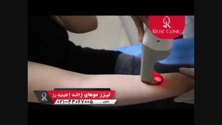 لیزر موهای زائد | لیزر مو | کلینیک پوست و مو رز | شماره 7 دندان پیش