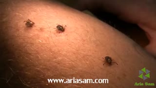 نیش کنه از نمای نزدیک