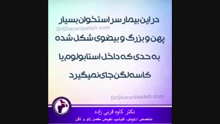 سیاه شدن سر استخوان ران