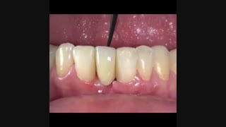 بریج مریلند