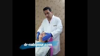 نخ لیفت و رفع غبغب با کاشت نخ pdo