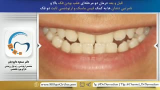دکتر داودیان | متخصص ارتودنسی