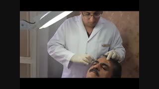 فیلر پیشانی اندودنتیکس