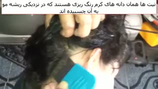 علائم شپش سر - نحوه از بین بردن شپش سر