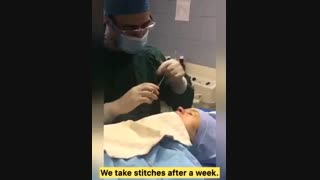 توضیح دکتر گلى درباره بخیه هاى جذبى وغیرجذبى درجراحى بینى