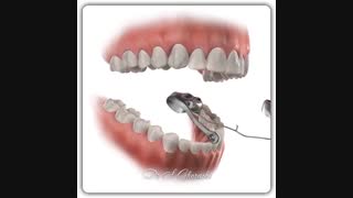 دستگاه فانکشنال ثابت | دکتر قریشی ابرسانی پوست