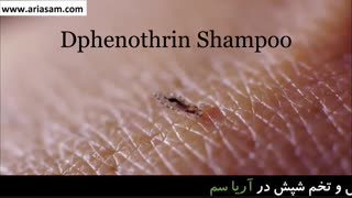 روشی آسان برای از بین بردن شپش