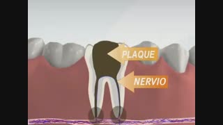 درمان ریشه دندان-دکترمجیدقیاسی
