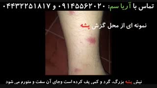 تشخیص نیش حشرات، کاری که باید بلد باشیم!!!