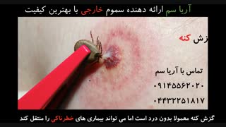 نمایی نزدیک از لحظه نیش زدن ساس