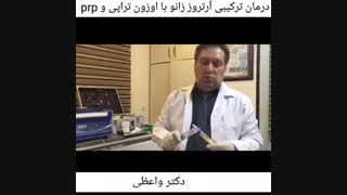 درمان آرتروز با پی ار پی