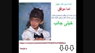 زشت ترین دختر جهان و اما موفق !!!!
