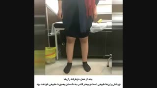 درمان چرخش ران ها