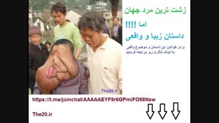 زشت ترین مرد جهان !!!!