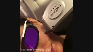 جوانسازی صورت و گردن با rf آر اف فرکشنال