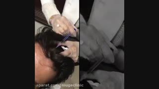 مزوتراپی مو دندانپزشکی کودکان
