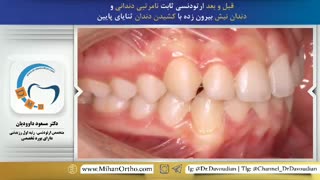 بهترین متخصص ارتودنسی تهران