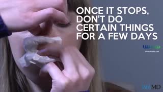 چگونه خون دماغ را بند آوریم؟