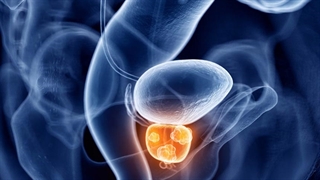 کارگاه آموزشی آگاهی رسانی و پیشگیری سرطان پروستات