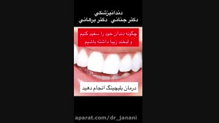 سفید کردن دندان تزریق چربی