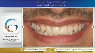 بهترین دکتر ارتودنسی