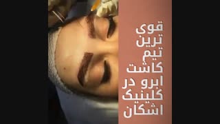 کاشت ابرو در کلینیک تخصصی زیبایی اشکان