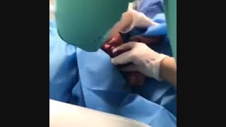 زایمان طبیعی