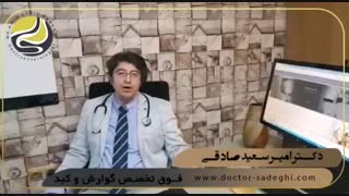 علت گیر کردن غذا در گلو (بلع دشوار)