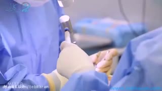 عمل جراحی بینی جراحی پلاستیک بینی